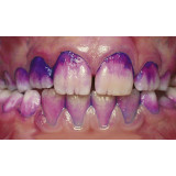 Curaprox Таблетки для индикации зубного налета 12 шт PCA223